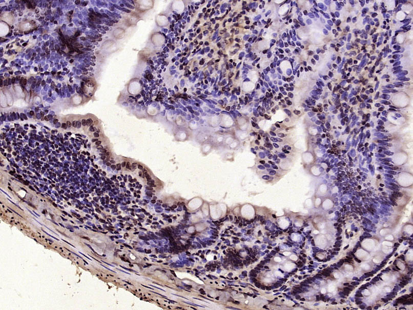 Paraformaldehyde-fixed, paraffin embedded Rat intestine; Antigen retrieval by boiling in sodium citrate buffer (pH6.0) for 15min; Block endogenous peroxidase by 3% hydrogen peroxide for 20 minutes; Blocking buffer (normal goat serum) at 37°C for 30min; Antibody incubation with Vitamin D Receptor/VDR Polyclonal Antibody, Unconjugated (bs-2987R) at 1:400 overnight at 4°C, DAB staining.