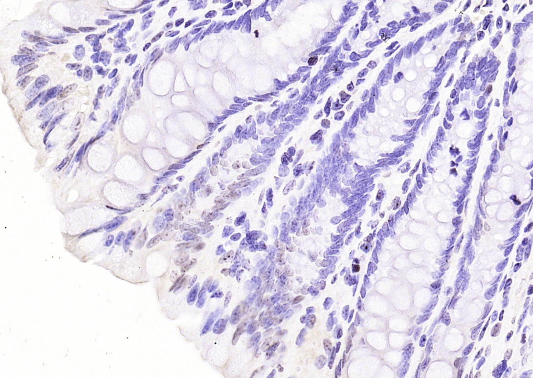 Paraformaldehyde-fixed, paraffin embedded Mouse colon; Antigen retrieval by boiling in sodium citrate buffer (pH6.0) for 15min; Block endogenous peroxidase by 3% hydrogen peroxide for 20 minutes; Blocking buffer (normal goat serum) at 37°C for 30min; Antibody incubation with HDAC4(Ser246)/HDAC5(Ser259)/HDAC7(Ser155) Polyclonal Antibody, Unconjugated (bs-3073R) at 1:200 overnight at 4°C, DAB staining.