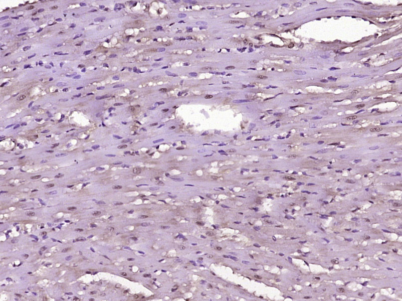 Paraformaldehyde-fixed, paraffin embedded Rat heart; Antigen retrieval by boiling in sodium citrate buffer (pH6.0) for 15min; Block endogenous peroxidase by 3% hydrogen peroxide for 20 minutes; Blocking buffer (normal goat serum) at 37°C for 30min; Antibody incubation with MEF2A (Ser408) Polyclonal Antibody, Unconjugated (bs-3268R) at 1:400 overnight at 4°C, DAB staining.