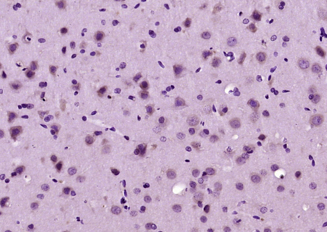 Paraformaldehyde-fixed, paraffin embedded Rat brain; Antigen retrieval by boiling in sodium citrate buffer (pH6.0) for 15min; Block endogenous peroxidase by 3% hydrogen peroxide for 20 minutes; Blocking buffer (normal goat serum) at 37°C for 30min; Antibody incubation with PLC gamma 1 (Tyr783) Polyclonal Antibody, Unconjugated (bs-3343R) at 1:200 overnight at 4°C, DAB staining.