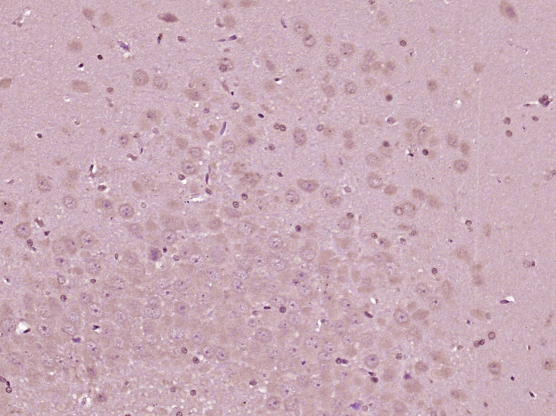 Paraformaldehyde-fixed, paraffin embedded Rat brain; Antigen retrieval by boiling in sodium citrate buffer (pH6.0) for 15min; Block endogenous peroxidase by 3% hydrogen peroxide for 20 minutes; Blocking buffer (normal goat serum) at 37°C for 30min; Antibody incubation with MAP3K8 (Ser400) Polyclonal Antibody, Unconjugated (bs-3454R) at 1:400 overnight at 4°C, DAB staining.