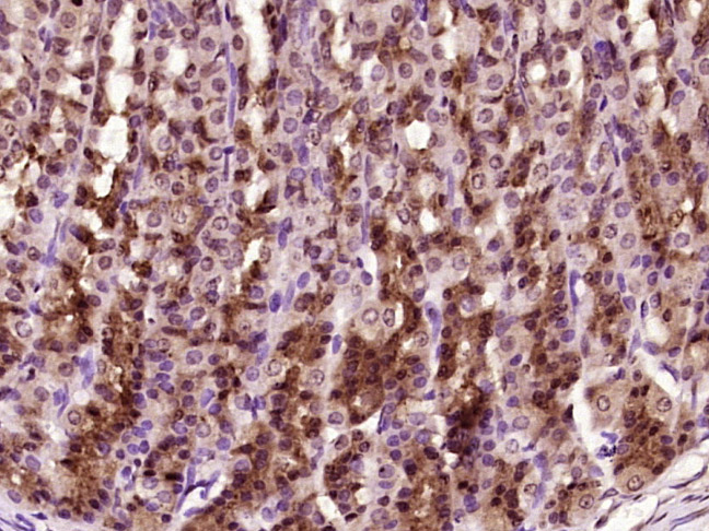 Paraformaldehyde-fixed, paraffin embedded Rat stomach; Antigen retrieval by boiling in sodium citrate buffer (pH6.0) for 15min; Block endogenous peroxidase by 3% hydrogen peroxide for 20 minutes; Blocking buffer (normal goat serum) at 37°C for 30min; Antibody incubation with YAP1(Tyr407) Polyclonal Antibody, Unconjugated (bs-3476R) at 1:400 overnight at 4°C, DAB staining.