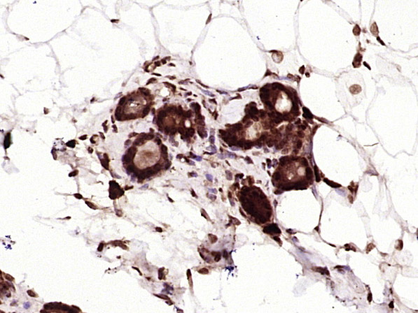 Paraformaldehyde-fixed, paraffin embedded Rat breast; Antigen retrieval by boiling in sodium citrate buffer (pH6.0) for 15min; Block endogenous peroxidase by 3% hydrogen peroxide for 20 minutes; Blocking buffer (normal goat serum) at 37°C for 30min; Antibody incubation with YAP1(Tyr407) Polyclonal Antibody, Unconjugated (bs-3476R) at 1:400 overnight at 4°C, DAB staining.