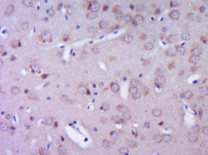 Paraformaldehyde-fixed, paraffin embedded Mouse brain; Antigen retrieval by boiling in sodium citrate buffer (pH6.0) for 15min; Block endogenous peroxidase by 3% hydrogen peroxide for 20 minutes; Blocking buffer (normal goat serum) at 37°C for 30min; Antibody incubation with RIP2 Polyclonal Antibody, Unconjugated (bs-3546R) at 1:400 overnight at 4°C, DAB staining.