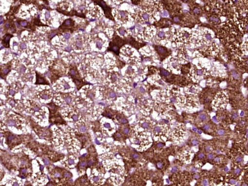 Paraformaldehyde-fixed, paraffin embedded Rat adrenal gland; Antigen retrieval by boiling in sodium citrate buffer (pH6.0) for 15min; Block endogenous peroxidase by 3% hydrogen peroxide for 20 minutes; Blocking buffer (normal goat serum) at 37°C for 30min; Antibody incubation with CYP11A1 Polyclonal Antibody, Unconjugated (bs-3608R) at 1:400 overnight at 4°C, DAB staining.