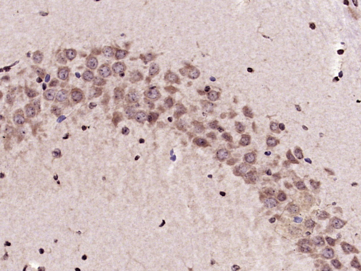 Paraformaldehyde-fixed, paraffin embedded Mouse brain; Antigen retrieval by boiling in sodium citrate buffer (pH6.0) for 15min; Block endogenous peroxidase by 3% hydrogen peroxide for 20 minutes; Blocking buffer (normal goat serum) at 37°C for 30min; Antibody incubation with KEAP1 Polyclonal Antibody, Unconjugated (bs-3648R) at 1:400 overnight at 4°C, DAB staining.