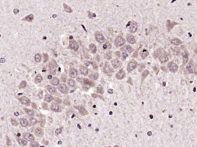 Paraformaldehyde-fixed, paraffin embedded Rat brain; Antigen retrieval by boiling in sodium citrate buffer (pH6.0) for 15min; Block endogenous peroxidase by 3% hydrogen peroxide for 20 minutes; Blocking buffer (normal goat serum) at 37°C for 30min; Antibody incubation with KEAP1 Polyclonal Antibody, Unconjugated (bs-3648R) at 1:400 overnight at 4°C, DAB staining.