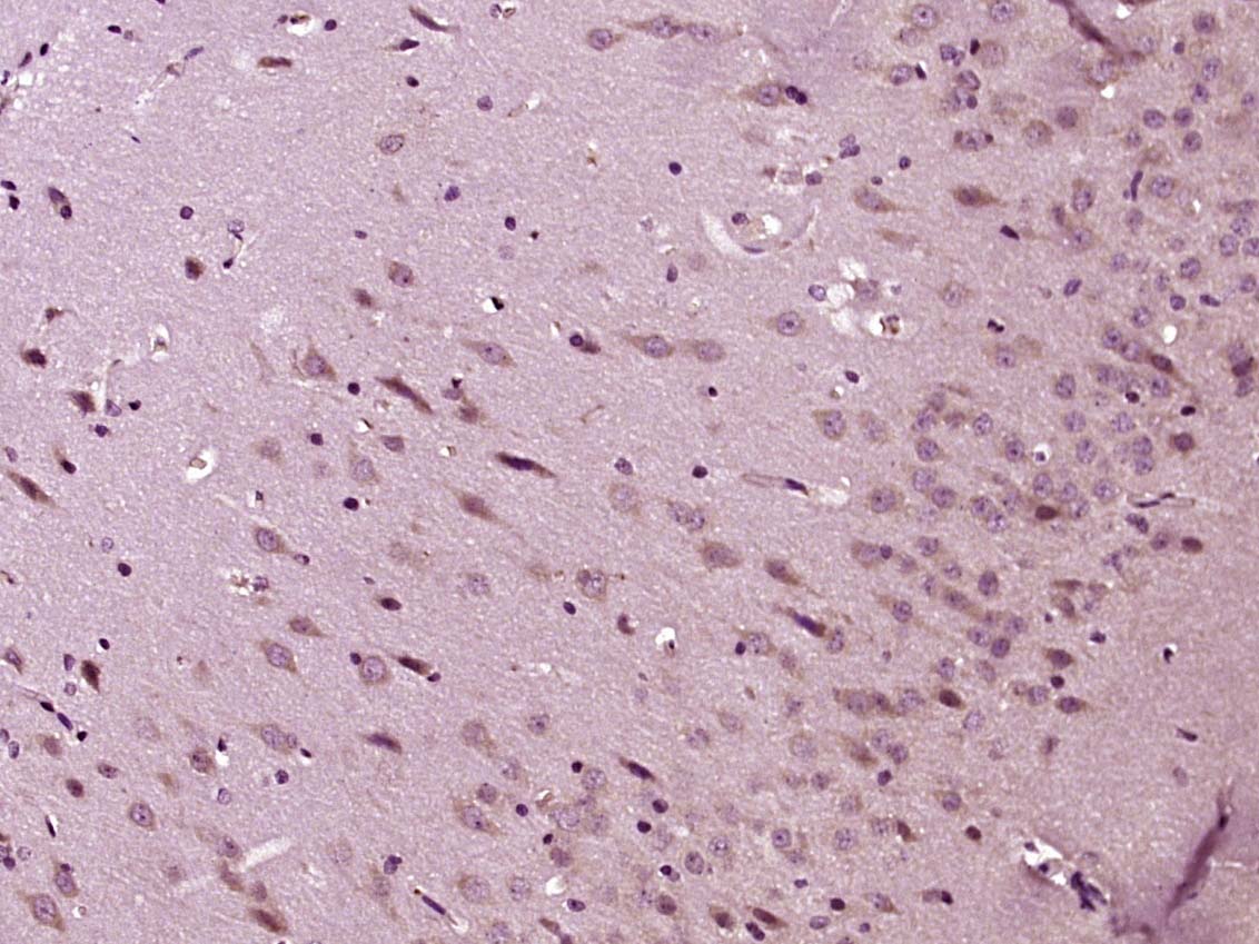 Paraformaldehyde-fixed, paraffin embedded Rat brain; Antigen retrieval by boiling in sodium citrate buffer (pH6.0) for 15min; Block endogenous peroxidase by 3% hydrogen peroxide for 20 minutes; Blocking buffer (normal goat serum) at 37\u00b0C for 30min; Antibody incubation with 5HT3B receptor Polyclonal Antibody, Unconjugated (bs-4289R) at 1:400 overnight at 4\u00b0C, DAB staining.