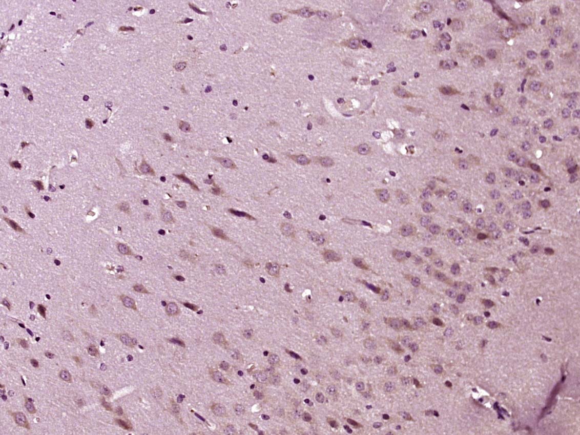 Paraformaldehyde-fixed, paraffin embedded Rat brain; Antigen retrieval by boiling in sodium citrate buffer (pH6.0) for 15min; Block endogenous peroxidase by 3% hydrogen peroxide for 20 minutes; Blocking buffer (normal goat serum) at 37°C for 30min; Antibody incubation with 5HT3B receptor Polyclonal Antibody, Unconjugated (bs-4289R) at 1:400 overnight at 4°C, DAB staining. Paraformaldehyde-fixed, paraffin embedded Rat brain; Antigen retrieval by boiling in sodium citrate buffer (pH6.0) for 15min; Block endogenous peroxidase by 3% hydrogen peroxide for 20 minutes; Blocking buffer (normal goat serum) at 37°C for 30min; Antibody incubation with 5HT3B receptor Polyclonal Antibody, Unconjugated (bs-4289R) at 1:400 overnight at 4°C, DAB staining.