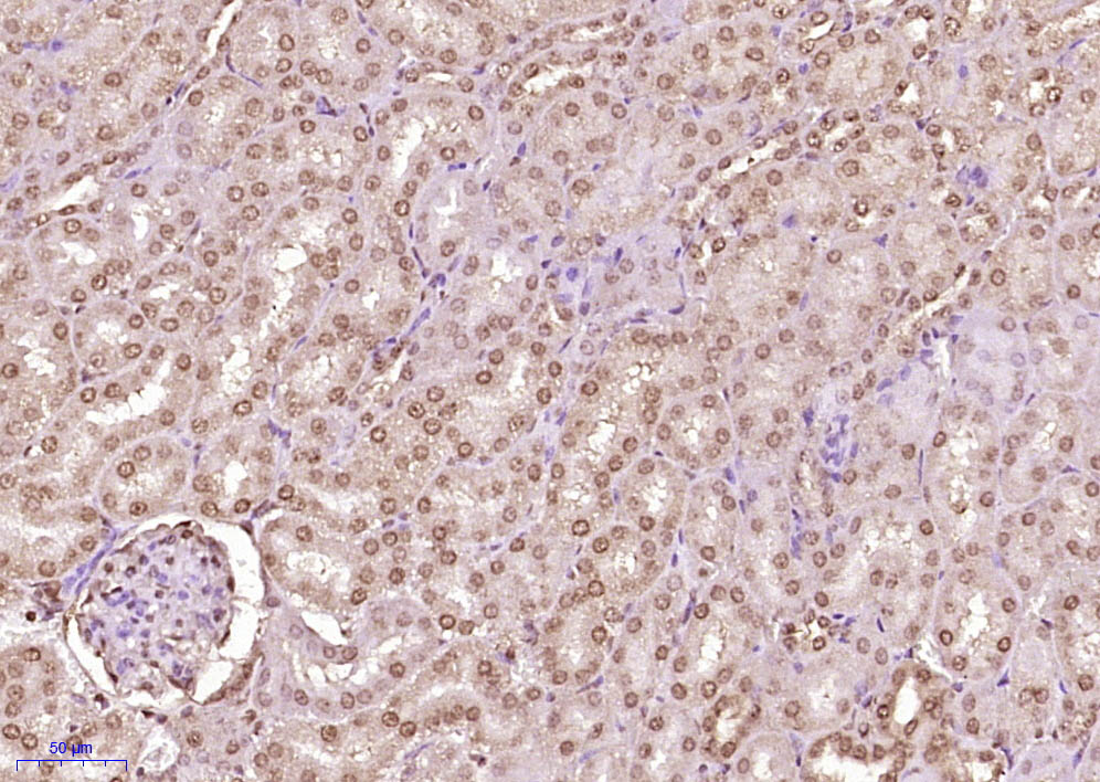 Paraformaldehyde-fixed, paraffin embedded Mouse kidney; Antigen retrieval by boiling in sodium citrate buffer (pH6.0) for 15min; Block endogenous peroxidase by 3% hydrogen peroxide for 20 minutes; Blocking buffer (normal goat serum) at 37°C for 30min; Antibody incubation with KAT8 Polyclonal Antibody, Unconjugated (bs-4312R) at 1:400 overnight at 4°C, DAB staining.