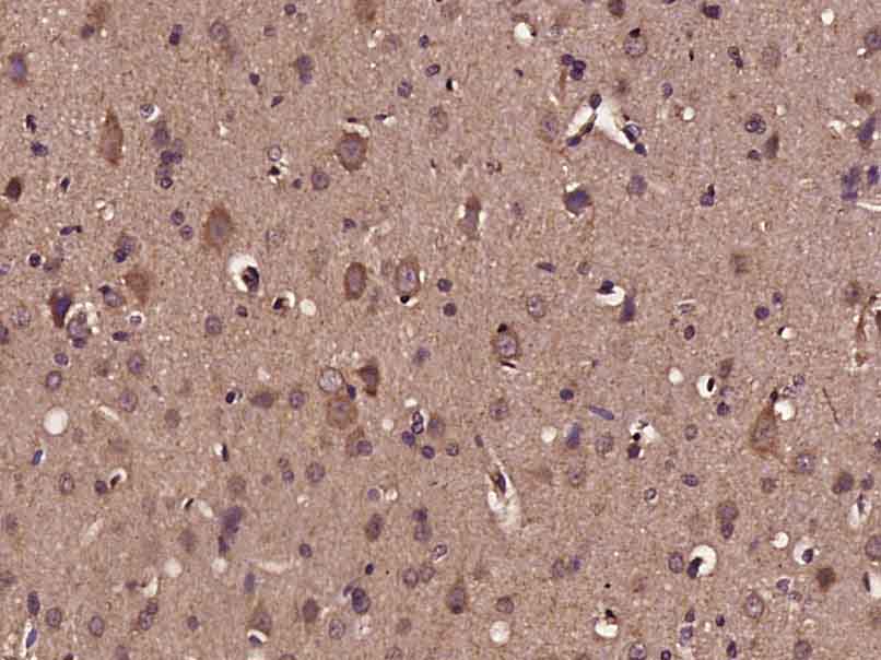Paraformaldehyde-fixed, paraffin embedded Mouse brain; Antigen retrieval by boiling in sodium citrate buffer (pH6.0) for 15min; Block endogenous peroxidase by 3% hydrogen peroxide for 20 minutes; Blocking buffer (normal goat serum) at 37\u00b0C for 30min; Antibody incubation with BDNF Polyclonal Antibody, Unconjugated (bs-4989R) at 1:400 overnight at 4\u00b0C, DAB staining.