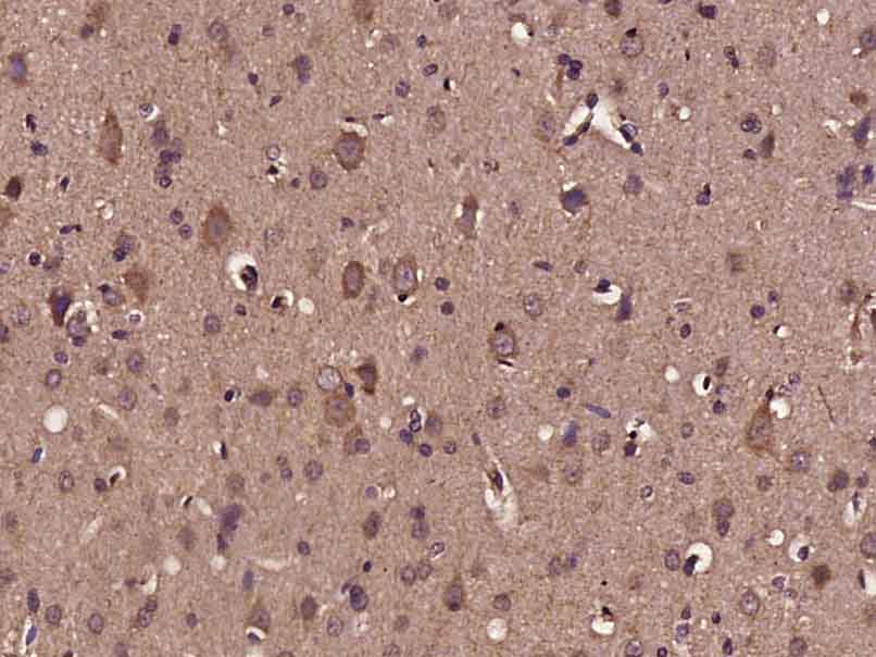 Paraformaldehyde-fixed, paraffin embedded Mouse brain; Antigen retrieval by boiling in sodium citrate buffer (pH6.0) for 15min; Block endogenous peroxidase by 3% hydrogen peroxide for 20 minutes; Blocking buffer (normal goat serum) at 37°C for 30min; Antibody incubation with BDNF Polyclonal Antibody, Unconjugated (bs-4989R) at 1:400 overnight at 4°C, DAB staining.