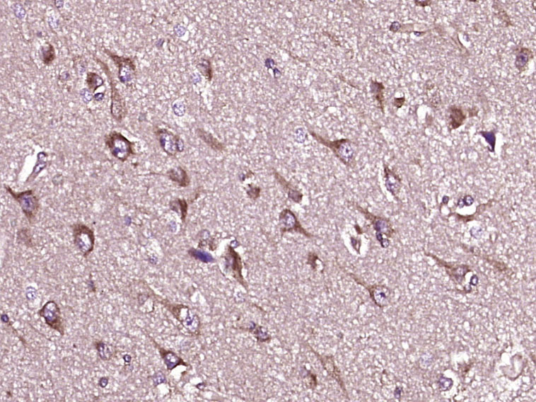 Paraformaldehyde-fixed, paraffin embedded Human brain glioma; Antigen retrieval by boiling in sodium citrate buffer (pH6.0) for 15min; Block endogenous peroxidase by 3% hydrogen peroxide for 20 minutes; Blocking buffer (normal goat serum) at 37°C for 30min; Antibody incubation with NNT Polyclonal Antibody, Unconjugated (bs-5097R) at 1:400 overnight at 4°C, DAB staining.