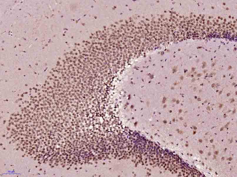 Paraformaldehyde-fixed, paraffin embedded Mouse brain; Antigen retrieval by boiling in sodium citrate buffer (pH6.0) for 15min; Block endogenous peroxidase by 3% hydrogen peroxide for 20 minutes; Blocking buffer (normal goat serum) at 37°C for 30min; Antibody incubation with AKT1/2/3 (Thr305/308/309) Polyclonal Antibody, Unconjugated (bs-5182R) at 1:400 overnight at 4°C, DAB staining.