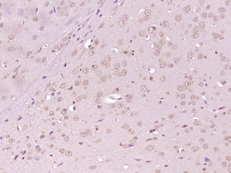 Paraformaldehyde-fixed, paraffin embedded Rat brain; Antigen retrieval by boiling in sodium citrate buffer (pH6.0) for 15min; Block endogenous peroxidase by 3% hydrogen peroxide for 20 minutes; Blocking buffer (normal goat serum) at 37°C for 30min; Antibody incubation with AKT1/2/3 (Thr305/308/309) Polyclonal Antibody, Unconjugated (bs-5182R) at 1:400 overnight at 4°C, DAB staining.