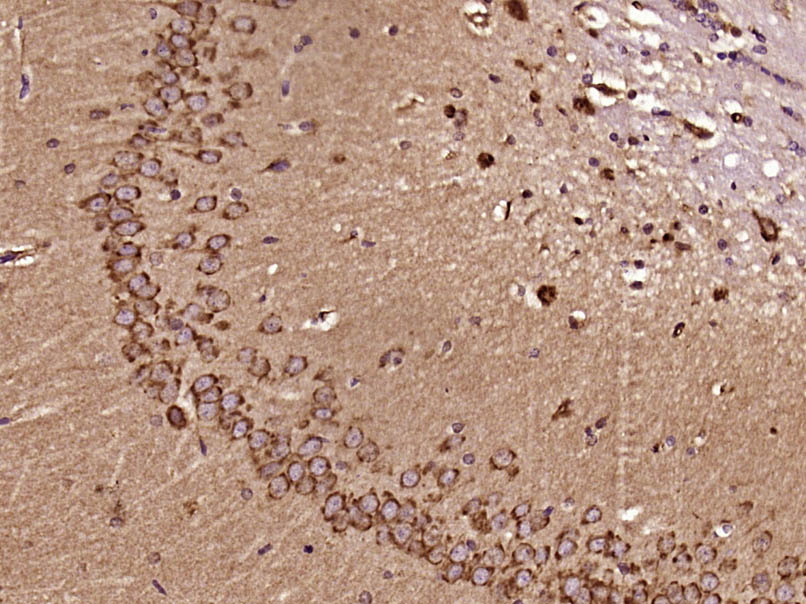 Paraformaldehyde-fixed, paraffin embedded Rat brain; Antigen retrieval by boiling in sodium citrate buffer (pH6.0) for 15min; Block endogenous peroxidase by 3% hydrogen peroxide for 20 minutes; Blocking buffer (normal goat serum) at 37°C for 30min; Antibody incubation with RhoA(Ser188) Polyclonal Antibody, Unconjugated (bs-5330R) at 1:400 overnight at 4°C, DAB staining.