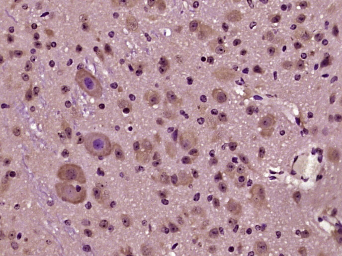 Paraformaldehyde-fixed, paraffin embedded Mouse cerebellum; Antigen retrieval by boiling in sodium citrate buffer (pH6.0) for 15min; Block endogenous peroxidase by 3% hydrogen peroxide for 20 minutes; Blocking buffer (normal goat serum) at 37°C for 30min; Antibody incubation with HOMER3 (Thr36) Polyclonal Antibody, Unconjugated (bs-5392R) at 1:400 overnight at 4°C, DAB staining.