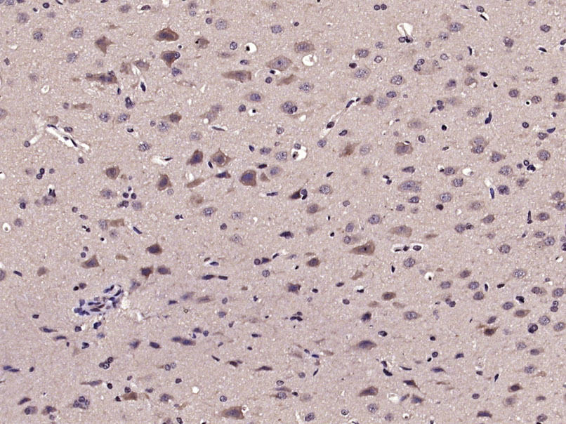 Paraformaldehyde-fixed, paraffin embedded Rat brain; Antigen retrieval by boiling in sodium citrate buffer (pH6.0) for 15min; Block endogenous peroxidase by 3% hydrogen peroxide for 20 minutes; Blocking buffer (normal goat serum) at 37°C for 30min; Antibody incubation with RIPK-1 Polyclonal Antibody, Unconjugated (bs-5805R) at 1:400 overnight at 4°C, DAB staining.