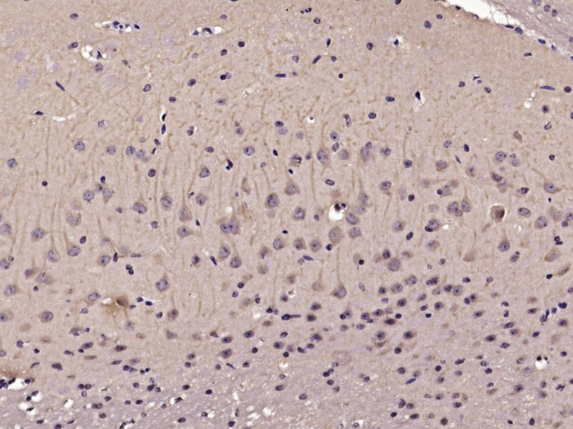 Paraformaldehyde-fixed, paraffin embedded Mouse brain; Antigen retrieval by boiling in sodium citrate buffer (pH6.0) for 15min; Block endogenous peroxidase by 3% hydrogen peroxide for 20 minutes; Blocking buffer (normal goat serum) at 37°C for 30min; Antibody incubation with RIPK-1 Polyclonal Antibody, Unconjugated (bs-5805R) at 1:400 overnight at 4°C, DAB staining.