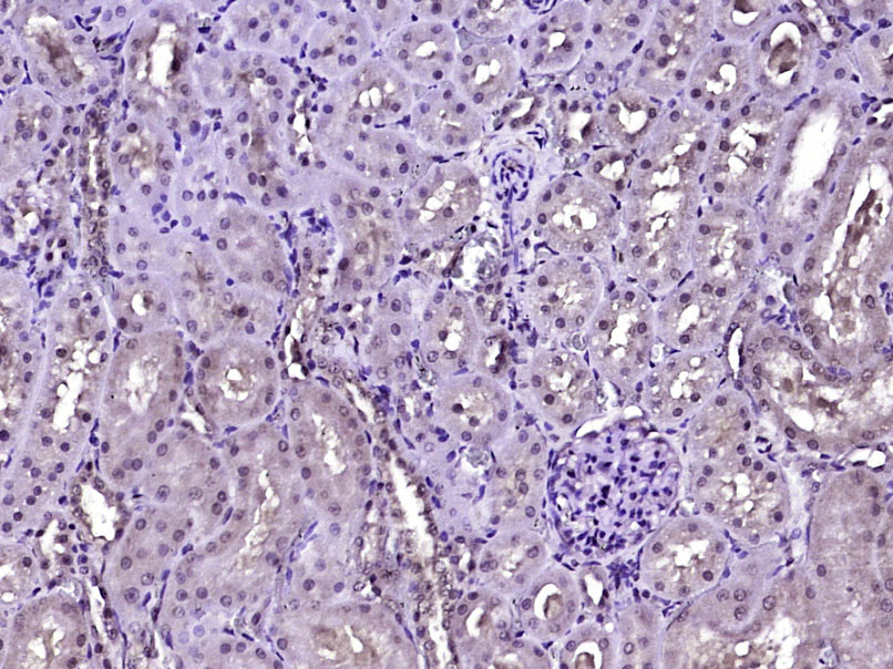 Paraformaldehyde-fixed, paraffin embedded Rat kidney; Antigen retrieval by boiling in sodium citrate buffer (pH6.0) for 15min; Block endogenous peroxidase by 3% hydrogen peroxide for 20 minutes; Blocking buffer (normal goat serum) at 37°C for 30min; Antibody incubation with HIF3 alpha Polyclonal Antibody, Unconjugated (bs-5898R) at 1:400 overnight at 4°C, DAB staining.