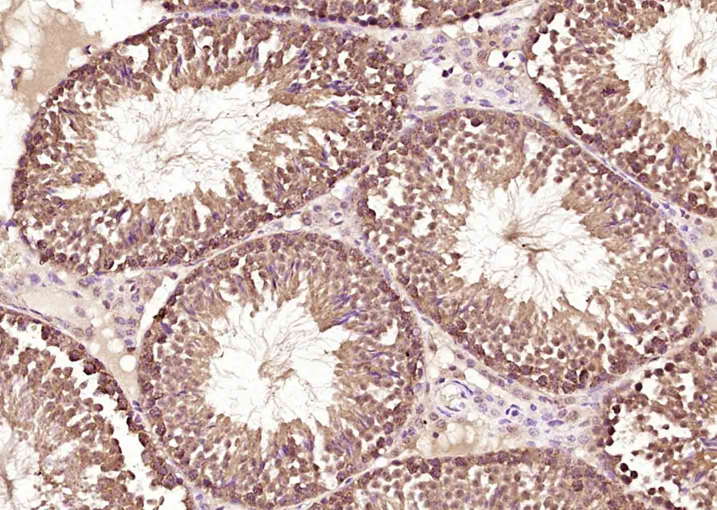 Paraformaldehyde-fixed, paraffin embedded Mouse testis; Antigen retrieval by boiling in sodium citrate buffer (pH6.0) for 15min; Block endogenous peroxidase by 3% hydrogen peroxide for 20 minutes; Blocking buffer (normal goat serum) at 37°C for 30min; Antibody incubation with RBM3 Polyclonal Antibody, Unconjugated (bs-5902R) at 1:200 overnight at 4°C, DAB staining.