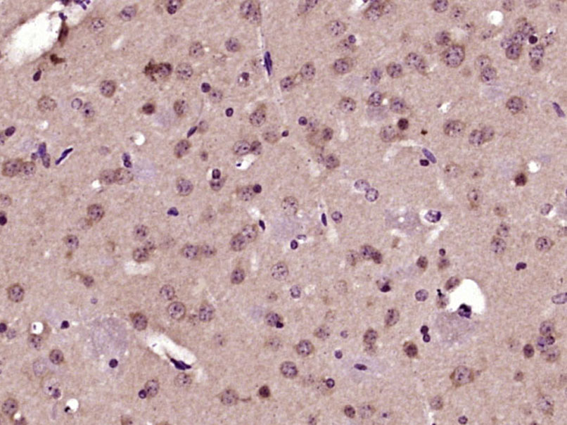 Paraformaldehyde-fixed, paraffin embedded Mouse brain; Antigen retrieval by boiling in sodium citrate buffer (pH6.0) for 15min; Block endogenous peroxidase by 3% hydrogen peroxide for 20 minutes; Blocking buffer (normal goat serum) at 37°C for 30min; Antibody incubation with Bcl2L2 Polyclonal Antibody, Unconjugated (bs-5903R) at 1:400 overnight at 4°C, DAB staining.
