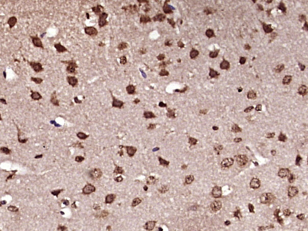 Paraformaldehyde-fixed, paraffin embedded Mouse brain; Antigen retrieval by boiling in sodium citrate buffer (pH6.0) for 15min; Block endogenous peroxidase by 3% hydrogen peroxide for 20 minutes; Blocking buffer (normal goat serum) at 37°C for 30min; Antibody incubation with Ferritin heavy chain Polyclonal Antibody, Unconjugated (bs-5907R) at 1:400 overnight at 4°C, DAB staining.