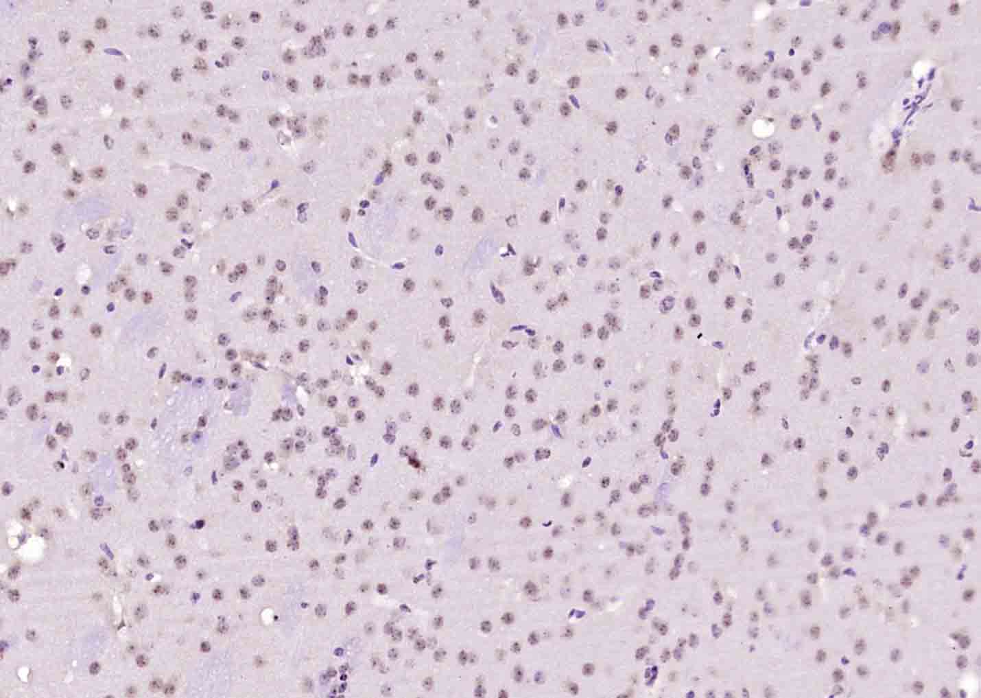 Paraformaldehyde-fixed, paraffin embedded Mouse brain; Antigen retrieval by boiling in sodium citrate buffer (pH6.0) for 15min; Block endogenous peroxidase by 3% hydrogen peroxide for 20 minutes; Blocking buffer (normal goat serum) at 37°C for 30min; Antibody incubation with NARG2 Polyclonal Antibody, Unconjugated (bs-5968R) at 1:400 overnight at 4°C, DAB staining.