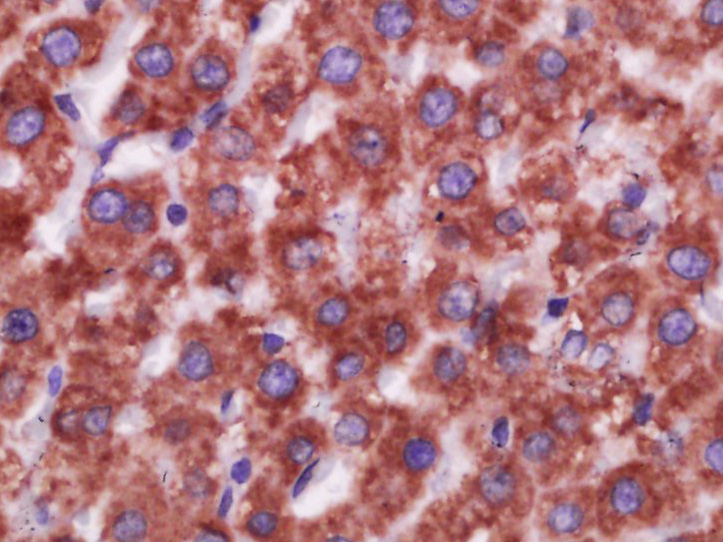 Paraformaldehyde-fixed, paraffin embedded Rat liver; Antigen retrieval by boiling in sodium citrate buffer (pH6.0) for 15min; Block endogenous peroxidase by 3% hydrogen peroxide for 20 minutes; Blocking buffer (normal goat serum) at 37°C for 30min; Antibody incubation with CD16 Polyclonal Antibody, Unconjugated (bs-6028R) at 1:400 overnight at 4°C, DAB staining.