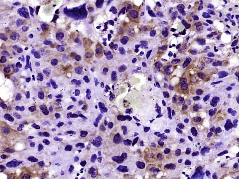 Paraformaldehyde-fixed, paraffin embedded Mouse placenta; Antigen retrieval by boiling in sodium citrate buffer (pH6.0) for 15min; Block endogenous peroxidase by 3% hydrogen peroxide for 20 minutes; Blocking buffer (normal goat serum) at 37°C for 30min; Antibody incubation with CD32B(Tyr292) Polyclonal Antibody, Unconjugated (bs-6028R) at 1:400 overnight at 4°C, DAB staining.