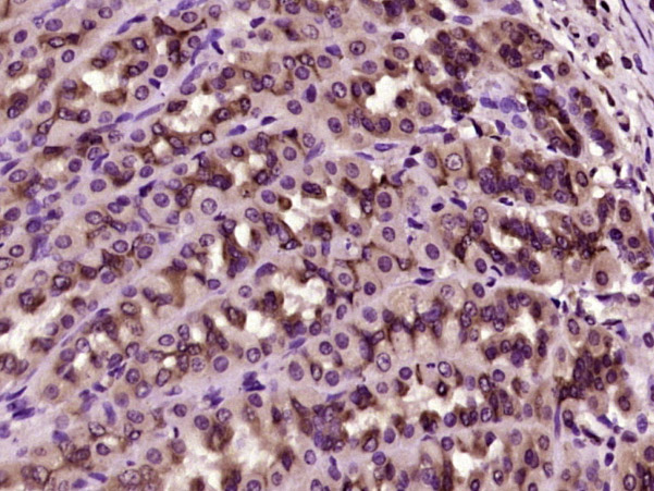Paraformaldehyde-fixed, paraffin embedded Rat stomach; Antigen retrieval by boiling in sodium citrate buffer (pH6.0) for 15min; Block endogenous peroxidase by 3% hydrogen peroxide for 20 minutes; Blocking buffer (normal goat serum) at 37°C for 30min; Antibody incubation with Prostaglandin dehydrogenase 1 Polyclonal Antibody, Unconjugated (bs-6051R) at 1:400 overnight at 4°C, DAB staining.