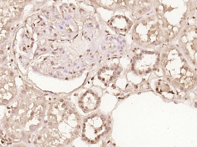 Paraformaldehyde-fixed, paraffin embedded Human kidney; Antigen retrieval by boiling in sodium citrate buffer (pH6.0) for 15min; Block endogenous peroxidase by 3% hydrogen peroxide for 20 minutes; Blocking buffer (normal goat serum) at 37°C for 30min; Antibody incubation with PRMT6 Polyclonal Antibody, Unconjugated (bs-6063R) at 1:400 overnight at 4°C, DAB staining.