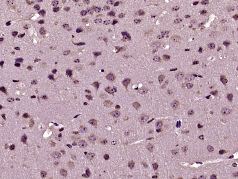 Paraformaldehyde-fixed, paraffin embedded Mouse brain; Antigen retrieval by boiling in sodium citrate buffer (pH6.0) for 15min; Block endogenous peroxidase by 3% hydrogen peroxide for 20 minutes; Blocking buffer (normal goat serum) at 37°C for 30min; Antibody incubation with RASSF3 Polyclonal Antibody, Unconjugated (bs-6078R) at 1:400 overnight at 4°C, DAB staining. Paraformaldehyde-fixed, paraffin embedded Mouse brain; Antigen retrieval by boiling in sodium citrate buffer (pH6.0) for 15min; Block endogenous peroxidase by 3% hydrogen peroxide for 20 minutes; Blocking buffer (normal goat serum) at 37°C for 30min; Antibody incubation with RASSF3 Polyclonal Antibody, Unconjugated (bs-6078R) at 1:400 overnight at 4°C, DAB staining.