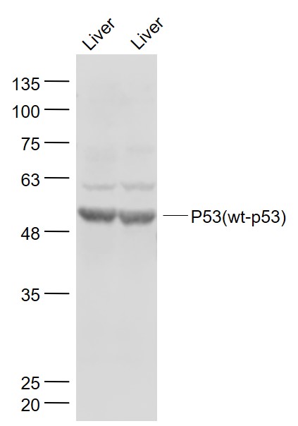 Lane 1: Mouse Liver lysates; Lane 2: Rat Liver lysates probed with P53(wt-p53) Polyclonal Antibody, Unconjugated (bs-2090R) at 1:1000 dilution and 4˚C overnight incubation. Followed by conjugated secondary antibody incubation at 1:20000 for 60 min at 37˚C.