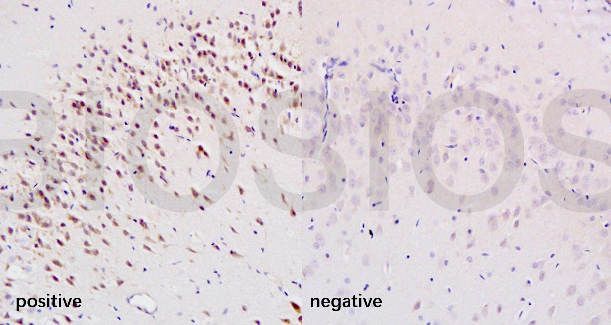Tissue\/cell: rat brain tissue(left panel was injury,Right panel was normal); 4% Paraformaldehyde-fixed and paraffin-embedded; \r\nAntigen retrieval: citrate buffer ( 0.01M, pH 6.0 ), Boiling bathing for 15min; Block endogenous peroxidase by 3% Hydrogen peroxide for 30min; Blocking buffer (normal goat serum,C-0005) at 37\u2103 for 20 min; \r\nIncubation: Anti-8-OHdG Polyclonal Antibody, Unconjugated (bs-1278R) 1:200, overnight at 4\u00b0C, followed by conjugation to the secondary antibody(SP-0023) and DAB(C-0010) staining