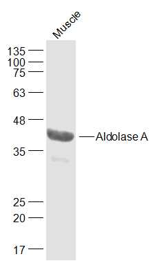 Lane 1: Mouse Muscle lysates probed with Aldolase A Polyclonal Antibody, Unconjugated (bs-2406R) at 1:1000 dilution and 4˚C overnight incubation. Followed by conjugated secondary antibody incubation at 1:20000 for 60 min at 37˚C.