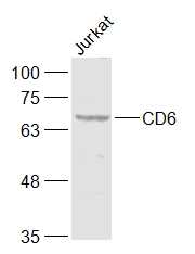 Lane 1: Jurkat cell lysates probed with CD6\/TP120 Polyclonal Antibody, Unconjugated (bs-2488R) at 1:1000 dilution and 4˚C overnight incubation. Followed by conjugated secondary antibody incubation at 1:20000 for 60 min at 37˚C.