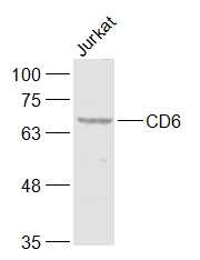 Lane 1: Jurkat cell lysates probed with CD6/TP120 Polyclonal Antibody, Unconjugated (bs-2488R) at 1:1000 dilution and 4˚C overnight incubation. Followed by conjugated secondary antibody incubation at 1:20000 for 60 min at 37˚C.