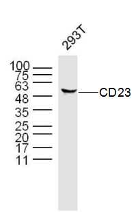 Lane 1: 293T cell lysates probed with CD23/Fc EpsilonR 2 Polyclonal Antibody, Unconjugated (bs-2490R) at 1:1000 dilution and 4˚C overnight incubation. Followed by conjugated secondary antibody incubation at 1:20000 for 60 min at 37˚C.