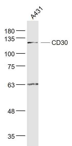 Lane 1: A431 cell lysates probed with CD30 Polyclonal Antibody, Unconjugated (bs-2495R) at 1:1000 dilution and 4˚C overnight incubation. Followed by conjugated secondary antibody incubation at 1:20000 for 60 min at 37˚C.