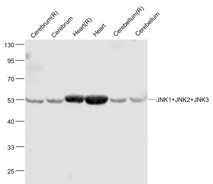 Lane 1: Rat Cerebrum lysates; Lane 2: Mouse Cerebrum lysates; Lane 3: Rat Heart lysates; Lane 4: Mouse Heart lysates ; Lane 5: Rat Cerebellum lysates ; Lane 6: Mouse Cerebellum lysates probed with JNK1+2+3 Polyclonal Antibody, Unconjugated (bs-2592R) at 1:1000 dilution and 4˚C overnight incubation. Followed by conjugated secondary antibody incubation at 1:20000 for 60 min at 37˚C.