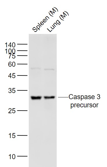 Lane 1: Mouse Spleen lysates; Lane 2: Mouse Lung lysates probed with Caspase 3 Polyclonal Antibody, Unconjugated (bs-2593R) at 1:1000 dilution and 4˚C overnight incubation. Followed by conjugated secondary antibody incubation at 1:20000 for 60 min at 37˚C.