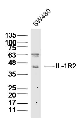 Lane 1: SW480 cell lysates probed with IL-1R2 Polyclonal Antibody, Unconjugated (bs-2595R) at 1:1000 dilution and 4˚C overnight incubation. Followed by conjugated secondary antibody incubation at 1:20000 for 60 min at 37˚C.