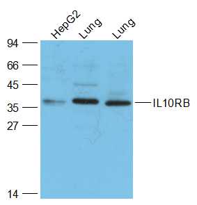 Lane 1: HepG2 cell lysates; Lane 2: Mouse Lung lysates; Lane 3: Rat Lung lysates probed with IL10RB Polyclonal Antibody, Unconjugated (bs-2602R) at 1:1000 dilution and 4˚C overnight incubation. Followed by conjugated secondary antibody incubation at 1:20000 for 60 min at 37˚C.