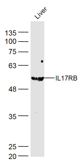 Lane 1: Mouse Liver lysates probed with IL-17RB Polyclonal Antibody, Unconjugated (bs-2610R) at 1:1000 dilution and 4˚C overnight incubation. Followed by conjugated secondary antibody incubation at 1:20000 for 60 min at 37˚C.