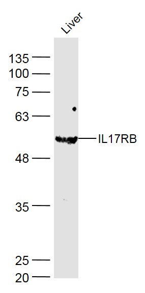 Lane 1: Mouse Liver lysates probed with IL-17RB Polyclonal Antibody, Unconjugated (bs-2610R) at 1:1000 dilution and 4˚C overnight incubation. Followed by conjugated secondary antibody incubation at 1:20000 for 60 min at 37˚C. Lane 1: Mouse Liver lysates probed with IL-17RB Polyclonal Antibody, Unconjugated (bs-2610R) at 1:1000 dilution and 4˚C overnight incubation. Followed by conjugated secondary antibody incubation at 1:20000 for 60 min at 37˚C.