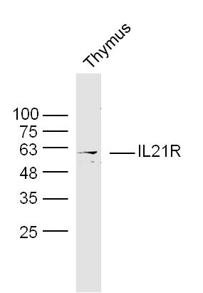 Lane 1: Mouse Thymus lysates probed with IL-21R Polyclonal Antibody, Unconjugated (bs-2622R) at 1:1000 dilution and 4˚C overnight incubation. Followed by conjugated secondary antibody incubation at 1:20000 for 60 min at 37˚C.