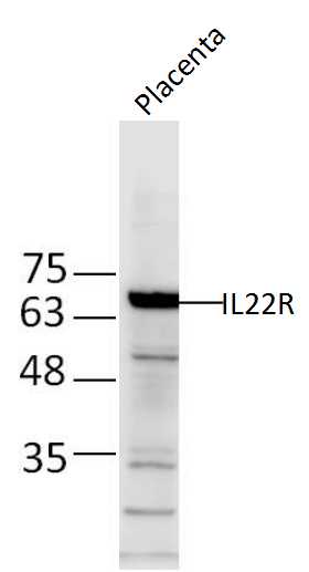 Lane 1: Mouse placenta lysates probed with IL-22R Polyclonal Antibody, Unconjugated (bs-2624R) at 1:1000 dilution and 4˚C overnight incubation. Followed by conjugated secondary antibody incubation at 1:20000 for 60 min at 37˚C.