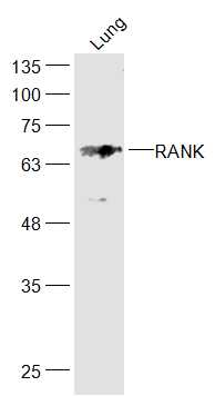 Lane 1: Mouse Lung lysates probed with RANK\/CD265 Polyclonal Antibody, Unconjugated (bs-2695R) at 1:1000 dilution and 4˚C overnight incubation. Followed by conjugated secondary antibody incubation at 1:20000 for 60 min at 37˚C.
