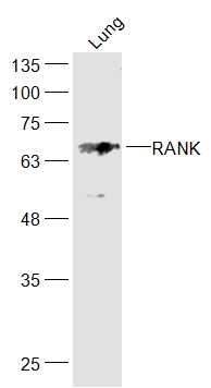Lane 1: Mouse Lung lysates probed with RANK/CD265 Polyclonal Antibody, Unconjugated (bs-2695R) at 1:1000 dilution and 4˚C overnight incubation. Followed by conjugated secondary antibody incubation at 1:20000 for 60 min at 37˚C.